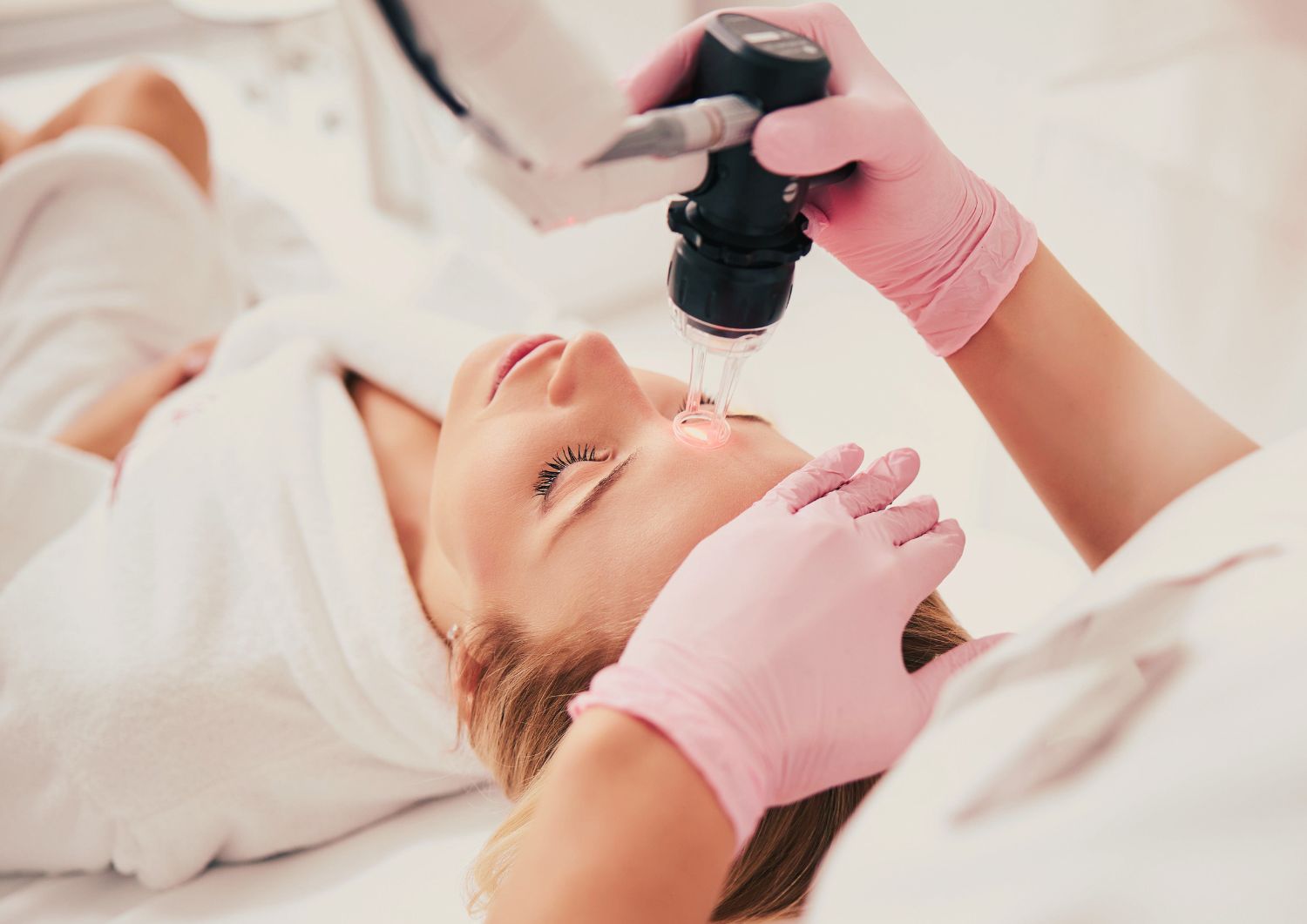 CO2 laser skin resurfacing periocular eyes